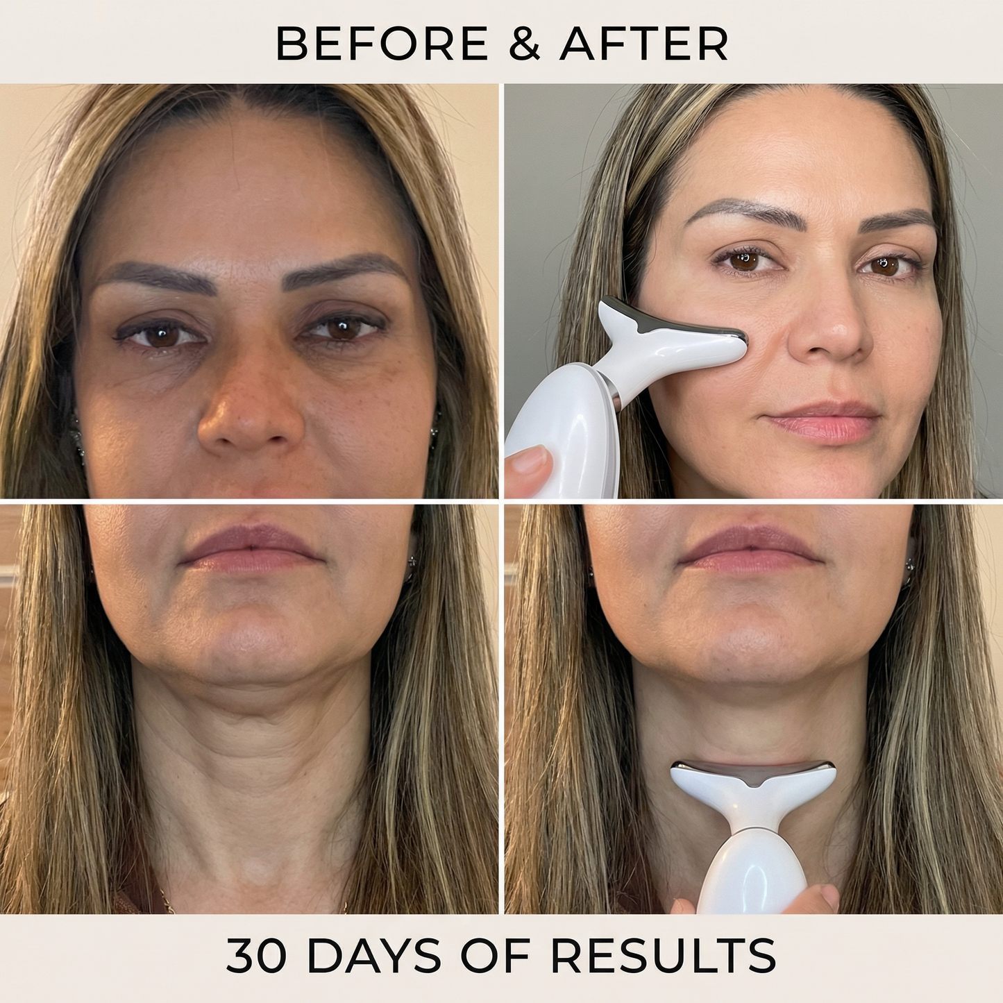 LED Neck & Face Lifting Device – Firming, Sculpting & Glow at Home